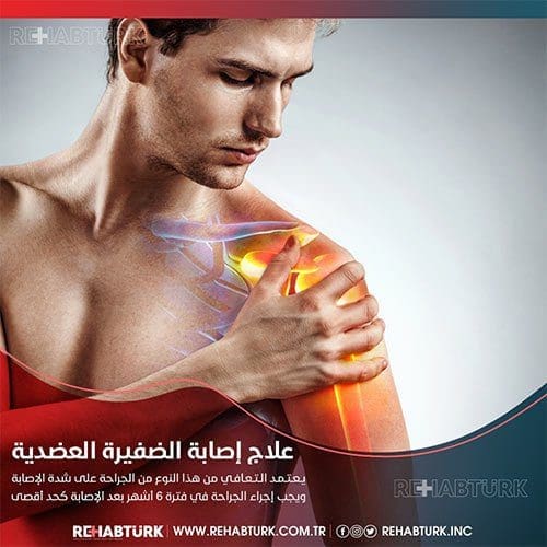 علاج إصابة الضفيرة العضدية في تركيا