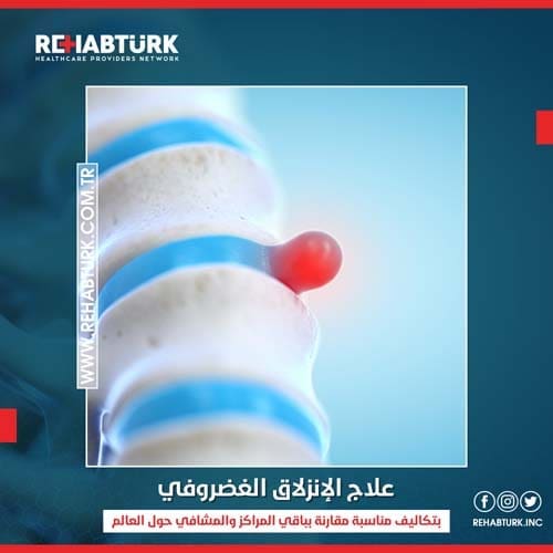 علاج الانزلاق الغضروفي في تركيا