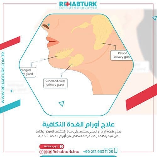 علاج أورام الغدة النكافية في تركيا