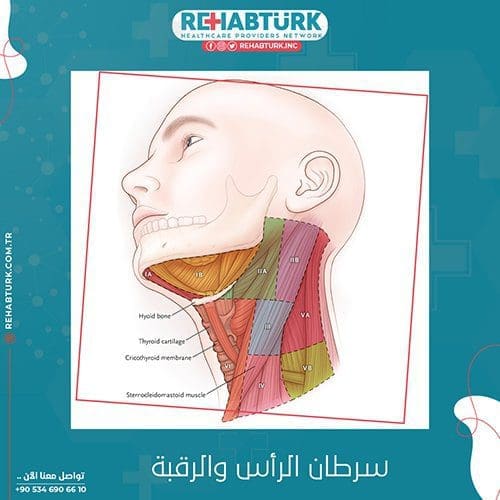 علاج سرطان الرأس والرقبة في تركيا