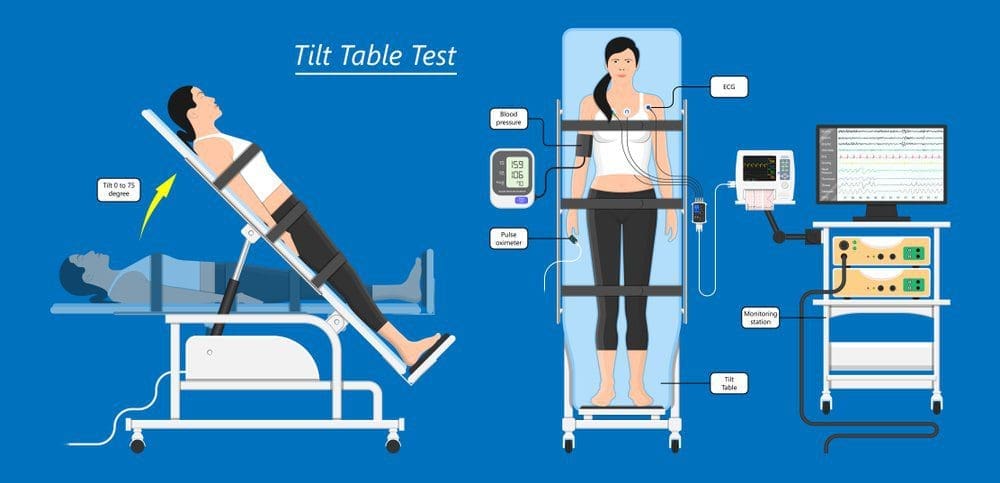 اختبار الطاولة المائلة في تركيا