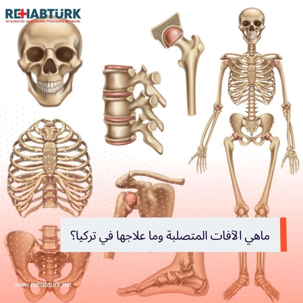 ماهي الآفات المتصلبة