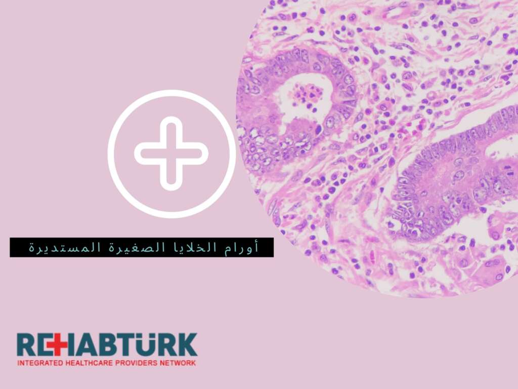 أورام الخلايا الصغيرة المستديرة أورام الخلايا الصغيرة المستديرة أورام الخلايا الصغيرة المستديرة