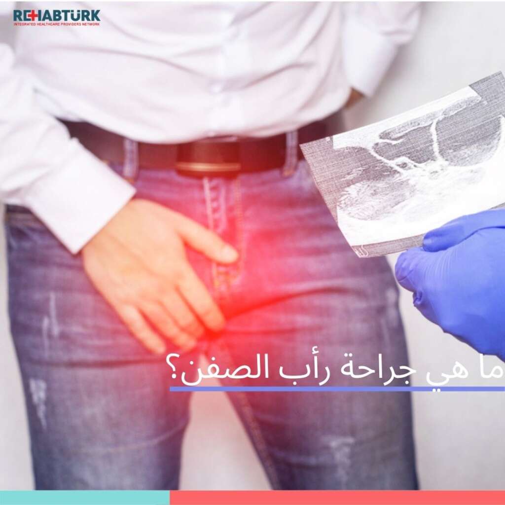 ما هي جراحة رأب الصفن في تركيا جراحة رأب الصفن رأب الصفن