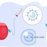 عملية ميكرو تيسي لعلاج العقم في تركيا
