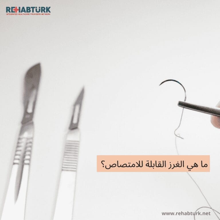 ما هي الغرز القابلة للامتصاص الغرز القابلة للامتصاص ما هي الغرز القابلة للامتصاص