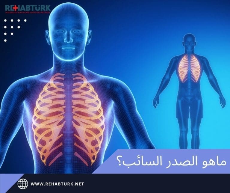 ما هو الصدر السائب ؟ و كيف يعالج في تركيا؟ الصدر السائب ما هو الصدر السائب ؟ و كيف يعالج في تركيا؟