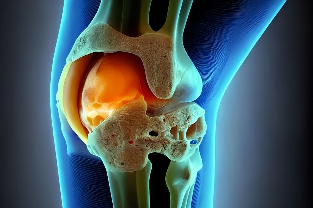 علاج تمزق الأربطة عند الرياضيين وكبار السن